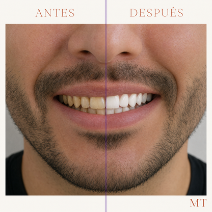 Antes y después en un hombre: dientes menos amarillos